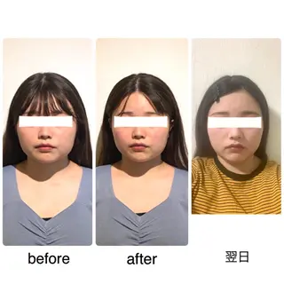 ロング カラー 小顔矯正専門サロンジュマリ所属・町田 淳子のエステ・リラクイメージ