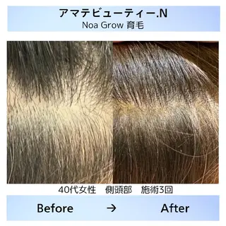 メンズ 痩身小顔専門 アマテ ビューティー.Nのエステ・リラクイメージ