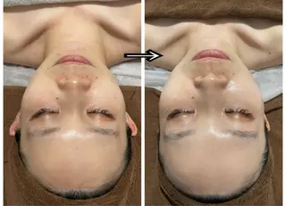 ENCHANT 脱毛.小顔.毛穴のエステ・リラクイメージ