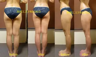 REGALO所属・矢野 さやかのエステ・リラクイメージ