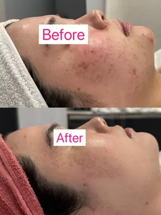 べアール所属・小顔/毛穴/白玉肌 salon bealのその他イメージ