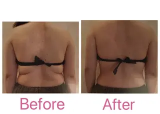 BELINDA銀座店 ✨痩身エステサロン✨のエステ・リラクイメージ