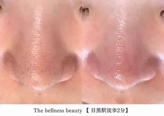 《毛穴レス美肌》ザ・ ベルネス 目黒駅2分のエステ・リラクイメージ