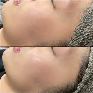 LiZA エステティックサロンのエステ・リラクイメージ