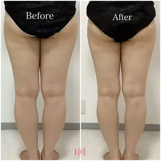 Liam《美肌管理/ 3D小顔/脂肪ケア》のその他イメージ