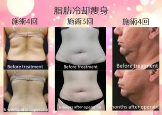 マツエク・マツパ 愛維美水光美肌専門店所属・愛維美水光美肌専門店 メンズレディースokのエステ・リラクイメージ