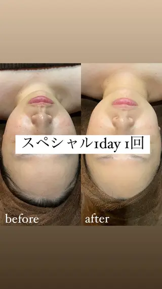 brilliance所属・老化肌トラブル肌専門 Brillianceのエステ・リラクイメージ