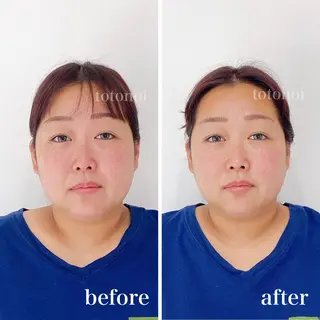 はり灸サロン　totonoi所属・筋膜リリース 小顔美容鍼のエステ・リラクイメージ