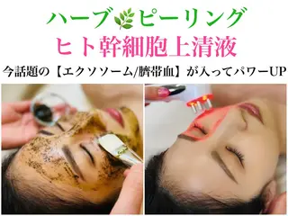 フェイシャル/脱毛 ジョアアンジェ　田中のエステ・リラクイメージ