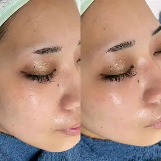 sara lazo 県病院前のマツエク・マツパデザイン