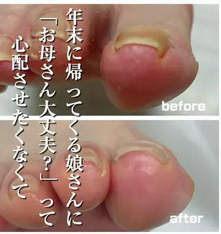 巻き爪フットケアサロンKotori所属・フットケアサロン Kotoriのその他イメージ