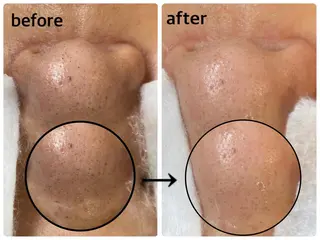 韓国肌管理 【毛穴専科】のエステ・リラクイメージ