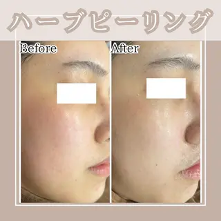 メンズ キッズ Amaryllis 🌹松本のエステ・リラクイメージ