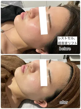 ENCHANT 脱毛.小顔.毛穴のエステ・リラクイメージ