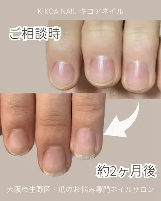 ネイル KIKOA NAIL キコアネイルのネイルデザイン