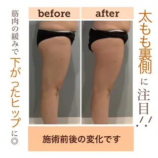 エステサロン JURISのエステ・リラクイメージ