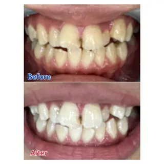 MBEAUTYSALON 千葉店・京成大久保所属・Melty 輝のその他イメージ