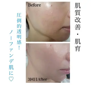 La　Beaute Verite所属・浅居 結菜のその他イメージ