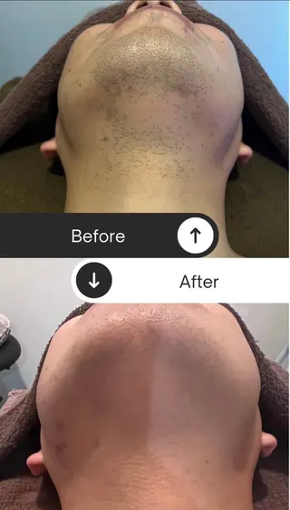 美PLACE所属・m oecaのエステ・リラクイメージ