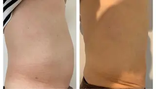 癒し腸もみサロン シャユーム　ゆきなのエステ・リラクイメージ