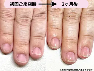 ネイル Ka pilina所属・自爪育成専門店 Kapilinaのネイルデザイン