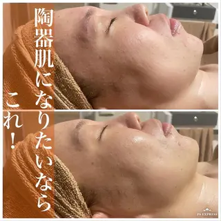 マツエク・マツパ ニキビ毛穴改善 🌿ハーブピーリングのエステ・リラクイメージ