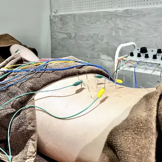 Spring鍼灸院所属・Spring鍼灸院 ✨首肩こり、腰痛に!のエステ・リラクイメージ