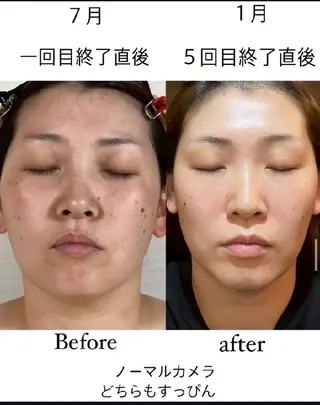 松岡 里美のエステ・リラクイメージ