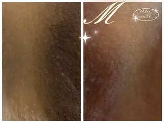 プライベート脱毛 Jr久宝寺のエステ・リラクイメージ