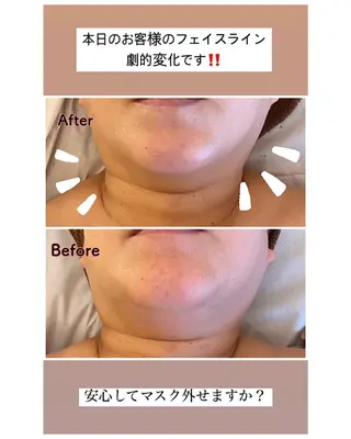 痩身リラク専門サロン 〜LUCIALL 〜のエステ・リラクイメージ