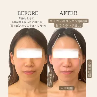 小顔/たるみ/黒ずみ除去専門サロン/SONA 大和西大寺店所属・【小顔専門看護師 サロンSONA】のエステ・リラクイメージ