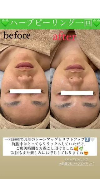 メンズ Salon de Lino 御器所のエステ・リラクイメージ