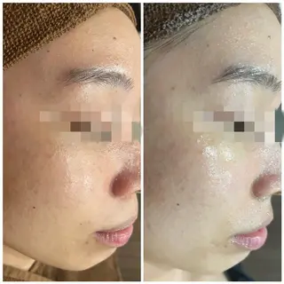 セミロング カラー パーマ ヘアアレンジ キッズ ネイル マツエク・マツパ アイブロウ Amaryllis 🌹松本のエステ・リラクイメージ