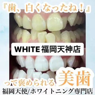 メンズ ホワイトニング専門店 WHITE天神店のエステ・リラクイメージ