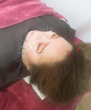 美容鍼灸女性専用 りんご鍼灸治療院のその他イメージ