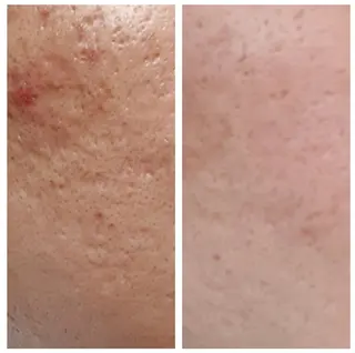 目元・まつパ・美肌フ ェイシャル谷町四丁目のマツエク・マツパデザイン