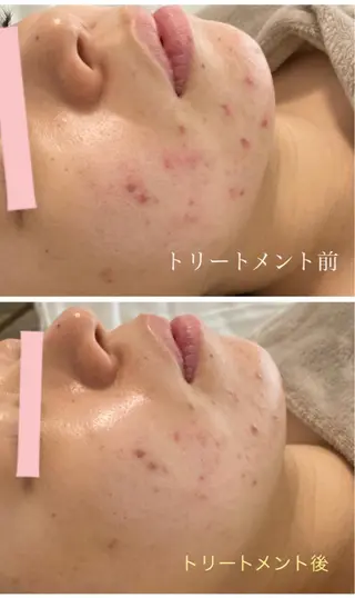 鍼灸サロン　MARINOTE所属・鍼灸サロン MARINOTEのエステ・リラクイメージ