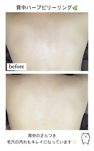 ベラージュ【美背中・ 美尻・フェイシャル】のエステ・リラクイメージ