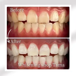 メンズ ホワイトニング ショップ多摩店のその他イメージ