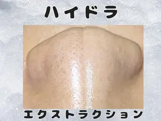 Beauty salon ハピー所属・大人女性のための 肌管理サロン　ハピーのエステ・リラクイメージ