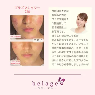 ベラージュ【美背中・ 美尻・フェイシャル】のエステ・リラクイメージ