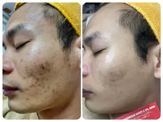 ニキビ、痩身、脱毛、 サクラチャンスパのエステ・リラクイメージ