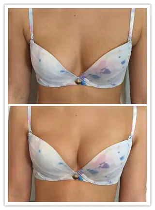 女性のお悩み美容 サロン ヴィーナスのエステ・リラクイメージ