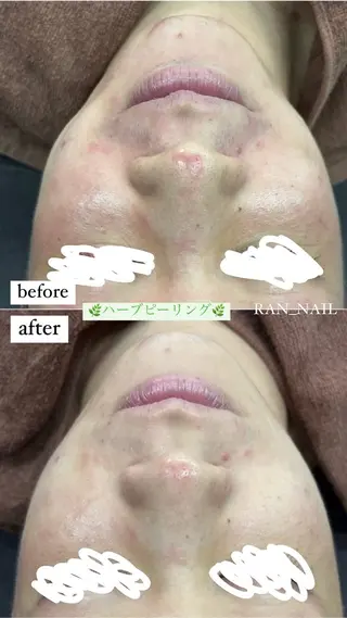 志免町 フェイスシャルエステのエステ・リラクイメージ