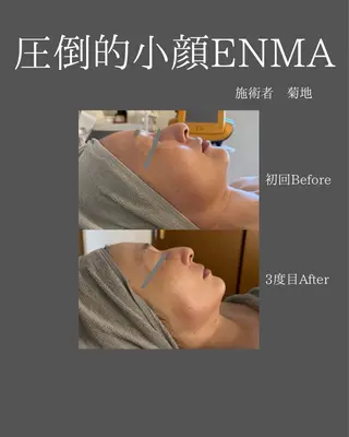 BLOSSOM 菊地のエステ・リラクイメージ