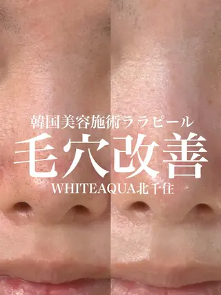 WHITE AQUA 北千住店のエステ・リラクイメージ