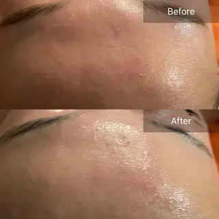 Mandarin Orange所属・毛穴から始める肌メン テマンダリンオレンジのエステ・リラクイメージ