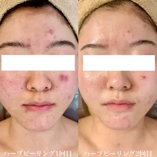 WHITE AQUA 北千住店のエステ・リラクイメージ