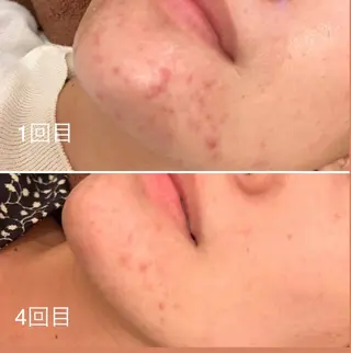 インディバベース あさみのエステ・リラクイメージ