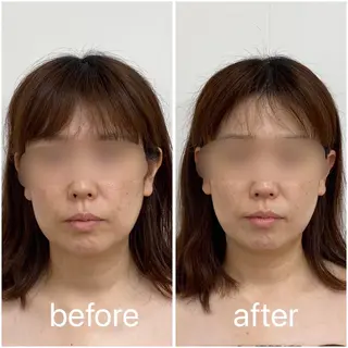小顔矯正サロンLily所属・小顔矯正サロン Lilyのエステ・リラクイメージ